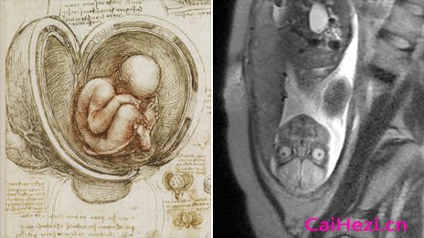 达芬奇绘制的胎儿素描图与数字成像技术获取的胎儿图像对比